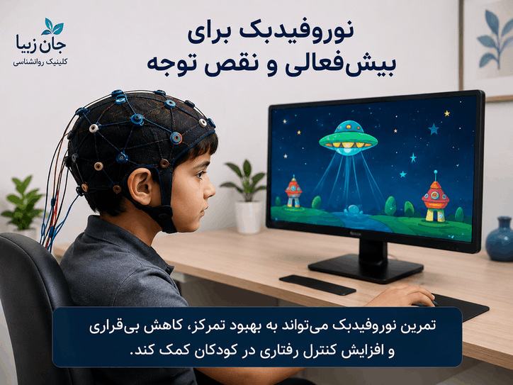 نوروفیدبک