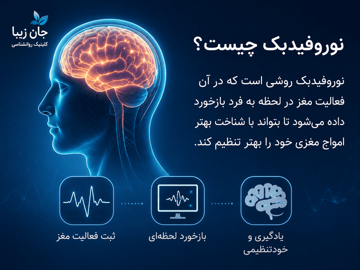 نوروفیدبک